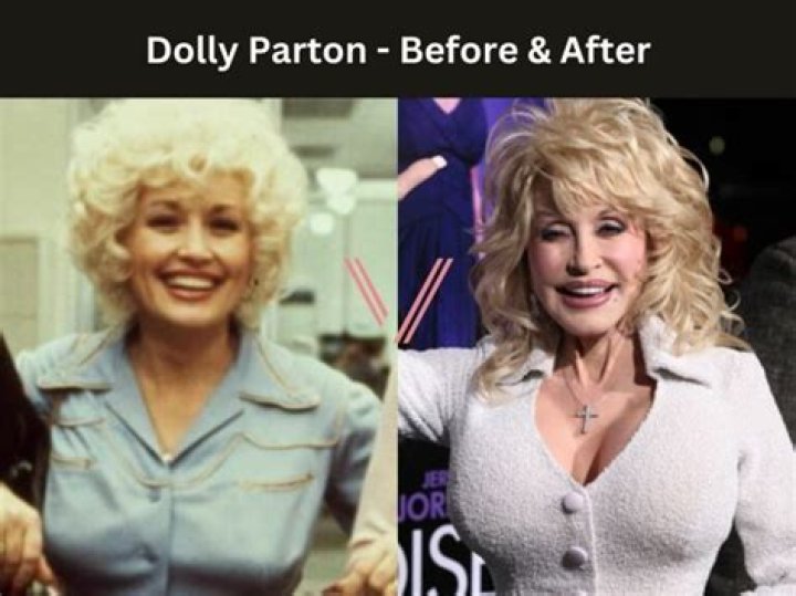 Dolly Parton's Voluptuous Chest: A Hollywood Icon's Enduring Legacy