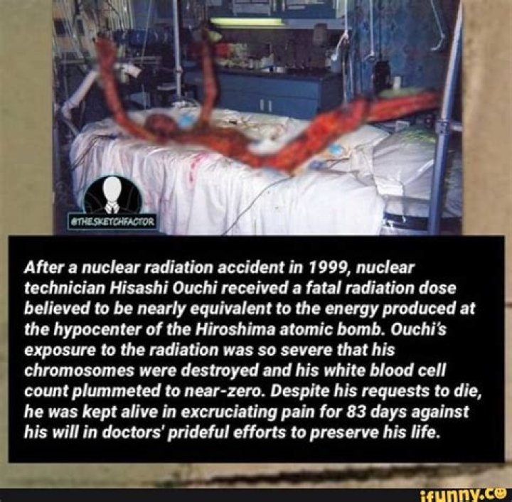 Hisashi Nuclear: History, Impact, And Lessons Learned