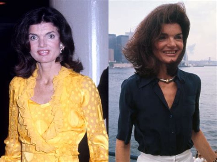 Jackie Onassis: A Life of Grace, Style, and Influence That Left an Indelible Mark