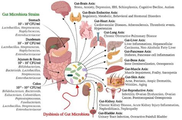 Mckinley Leak: A Comprehensive Guide To Causes, Effects, And Prevention