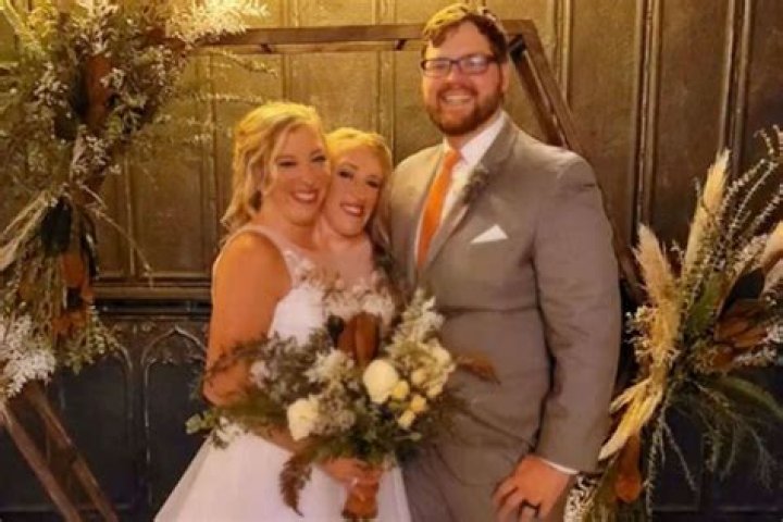 The Latest On The Hensel Twins: Breaking News And Updates