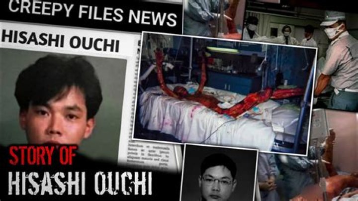 The Tragic Demise Of Hisashi Ouchi: How Did He Perish?