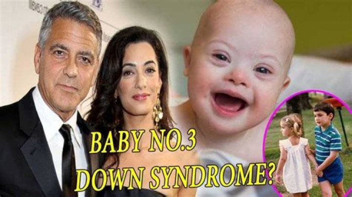 Unveiling The Truth: George Clooney's Down's Syndrome Child