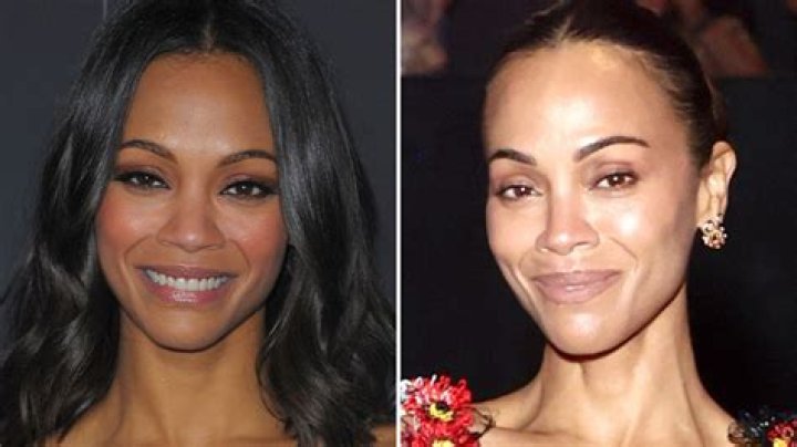 Zoe Saldana Plastic Surgery: The Truth Behind the Rumors